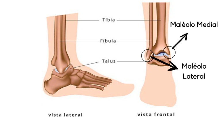fratura do maléolo medial e maléolo lateral