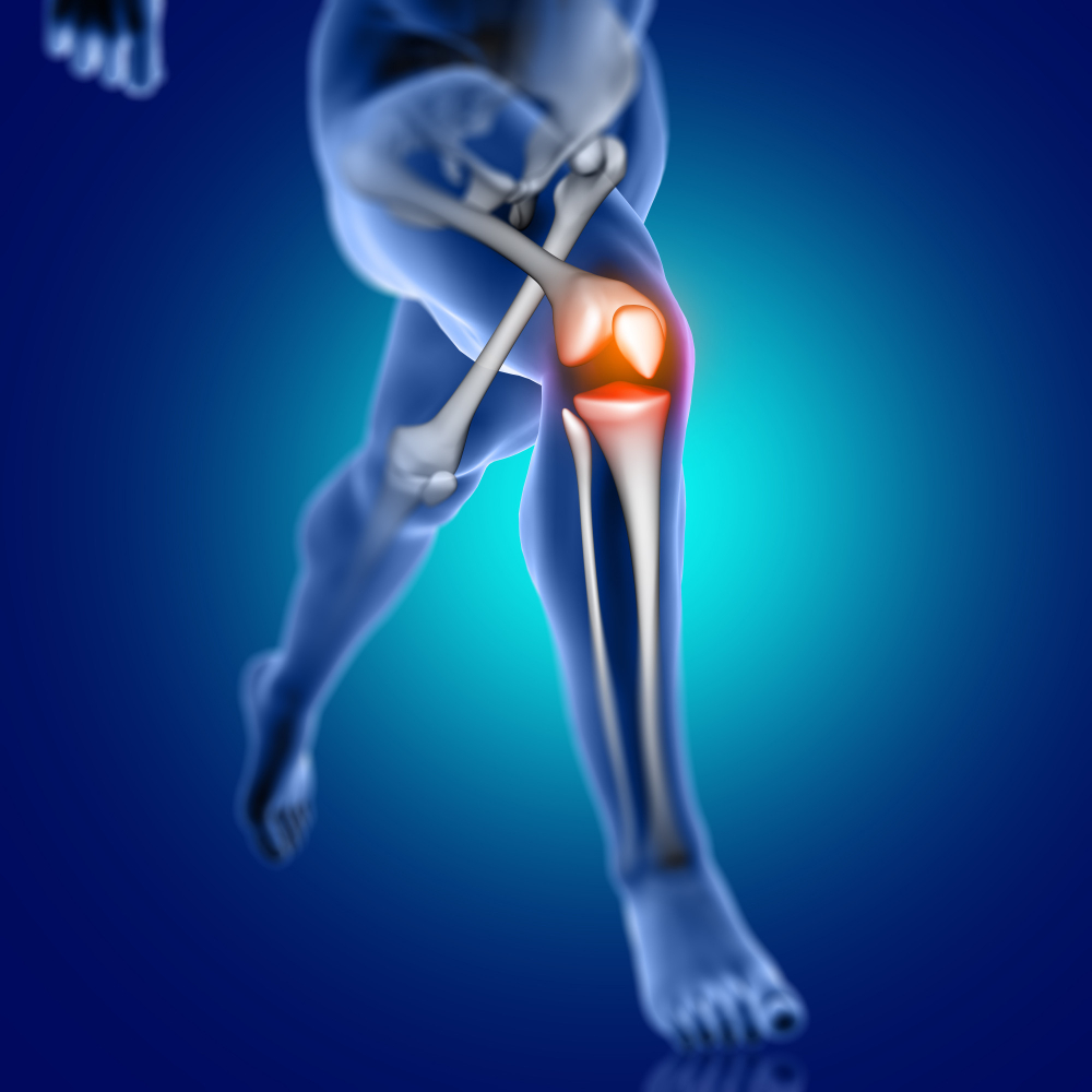 imagem do ligamento posterior do joelho - Daniel Baumfeld especialista em pés e tornozelo