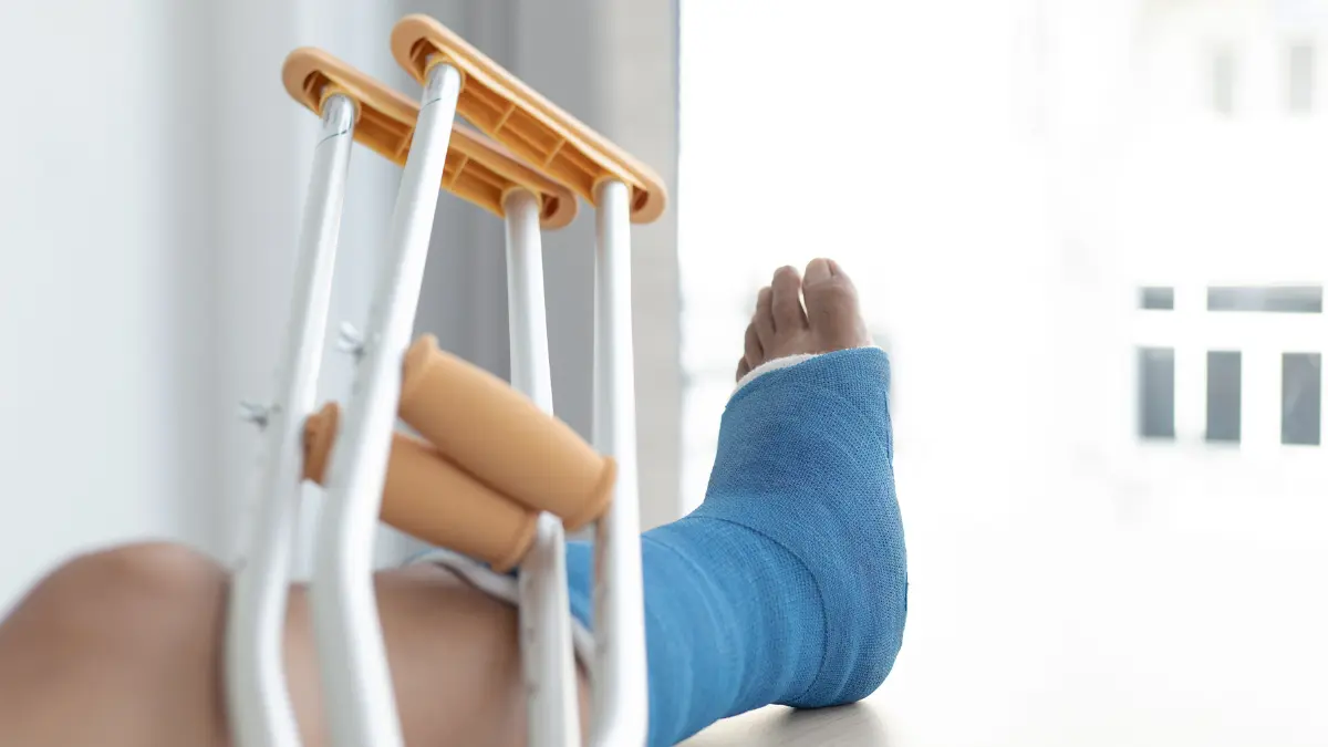 fratura 5 metatarso tempo recuperação com o Dr. Daniel baumfeld