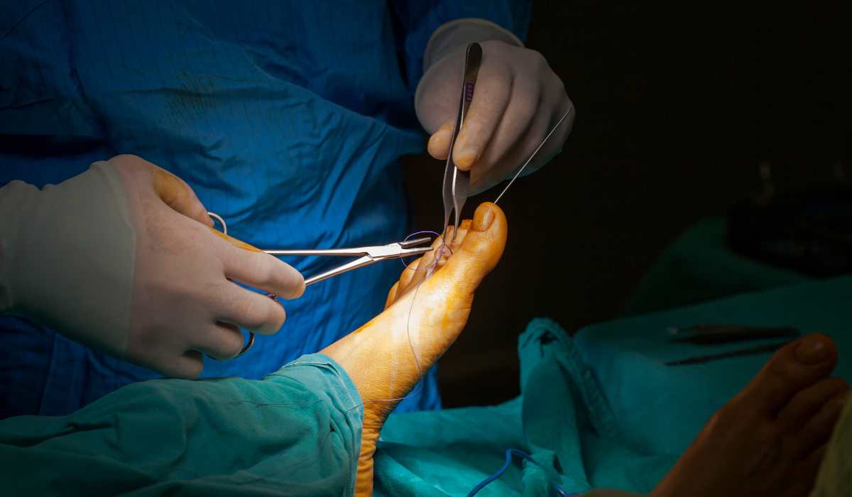 Cirurgia nos pés - Daniel Baumfeld