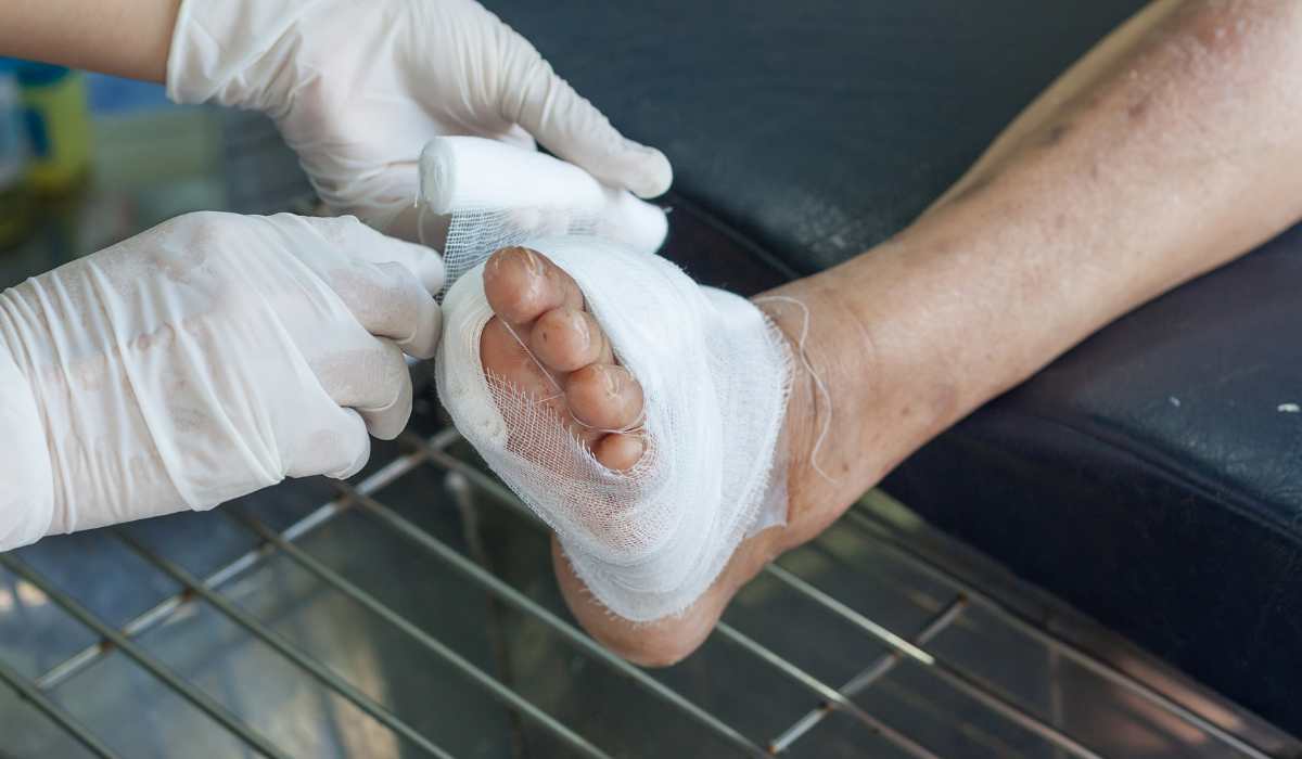Pé diabético - Daniel Baumfeld