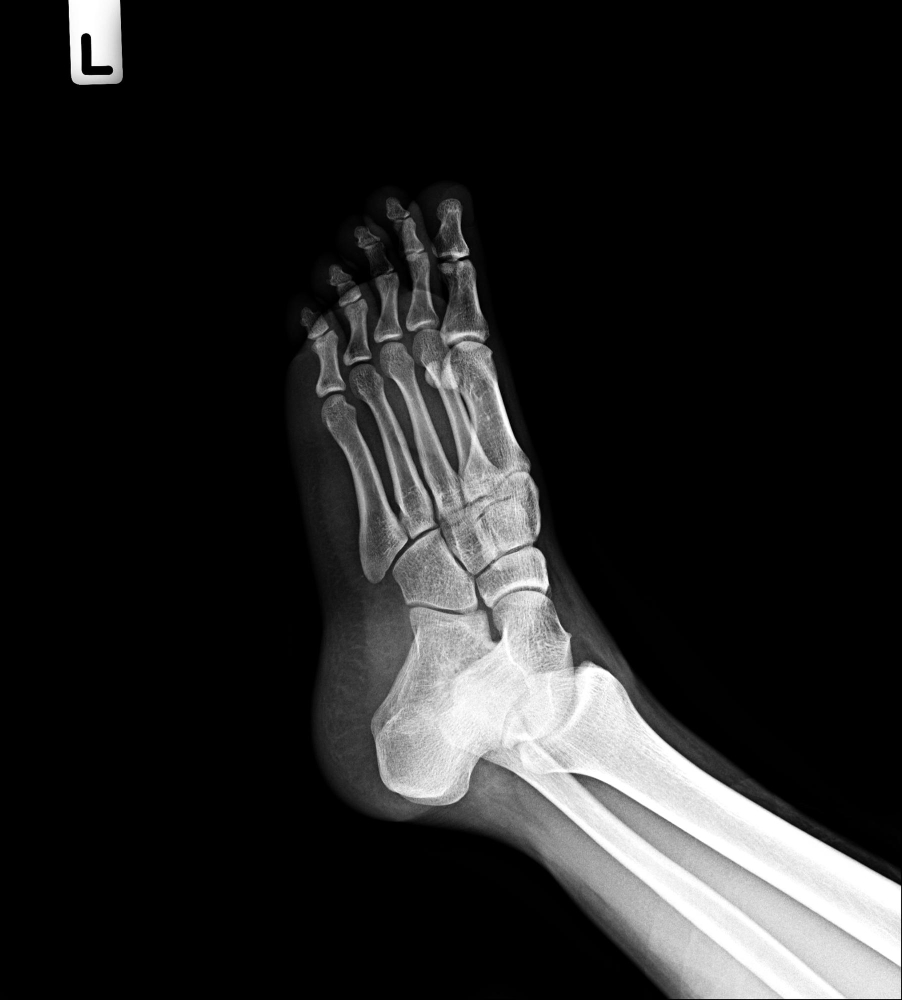 Demonstração técnica de posicionamento do paciente para radiografia do tornozelo