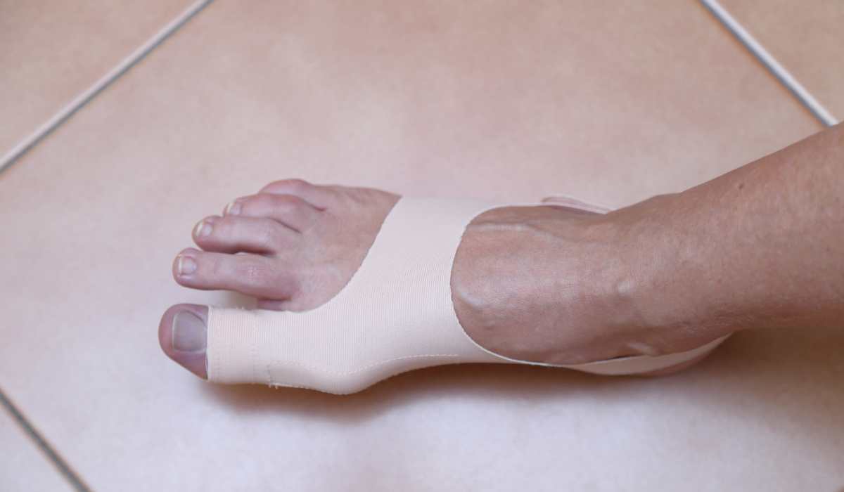 Tempo recuperação cirurgia hallux rigidus - Daniel Baumfeld