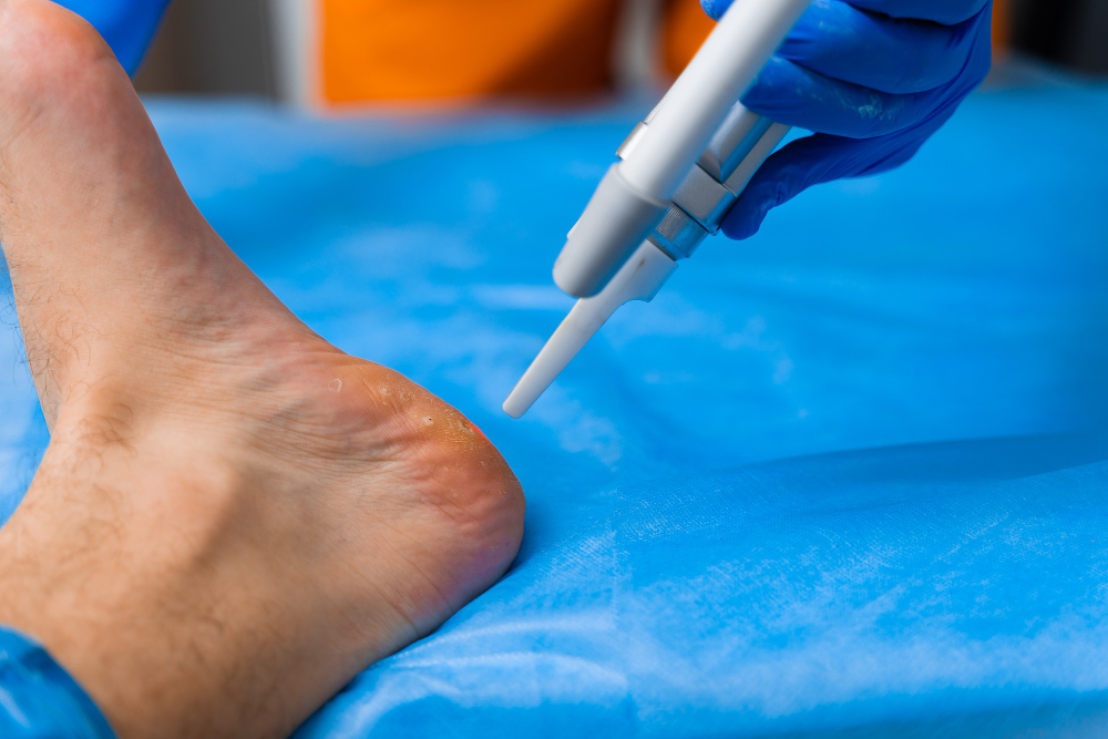 Tipos de cirurgia no pé - Dr. Daniel Baumfeld
