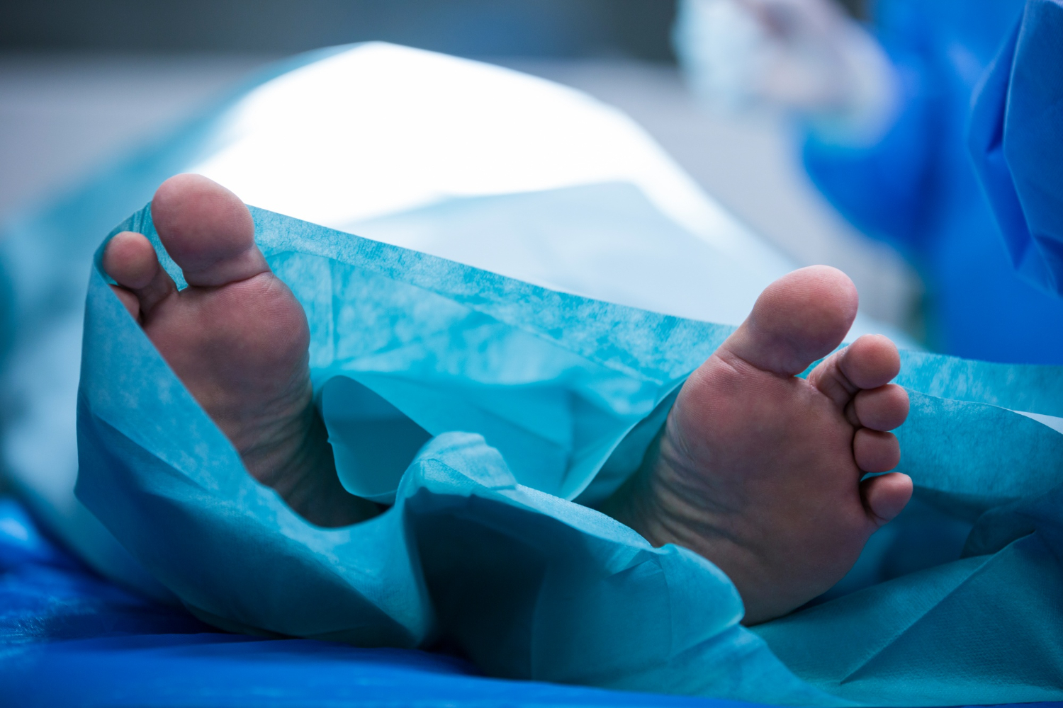 Correção de pé cavo: quando a cirurgia é necessária?